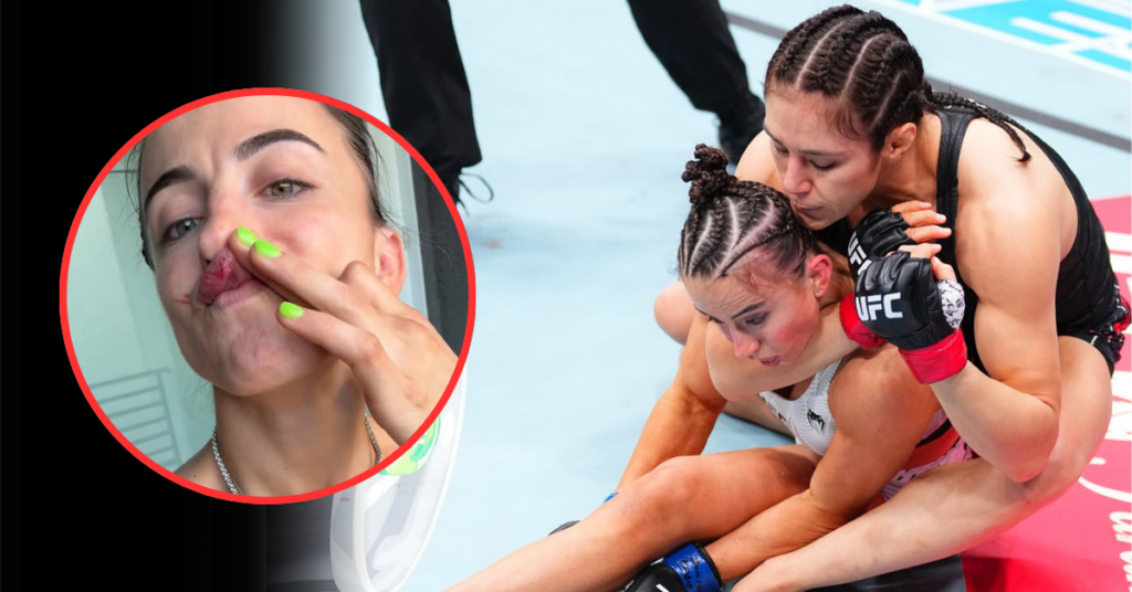 Maycee Barber Details Scary Consequences After Brutal Loss To Alexa Grasso At UFC Seattle