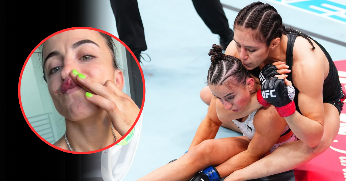 Maycee Barber Details Scary Consequences After Brutal Loss To Alexa Grasso At UFC Seattle: “I Look Like I’m Dead”